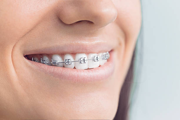 Best Teeth Whitening  in Center Point, AL